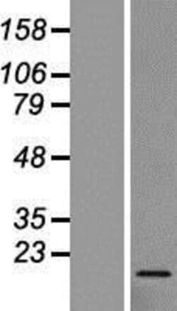 Novus Biologicals&trade;&nbsp;RPL27 Overexpression Lysate