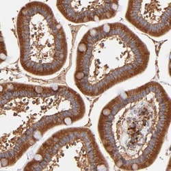 RPL27 Antibody, Novus Biologicals 0.1mL; Unlabeled:Antibodies, Polyclonal