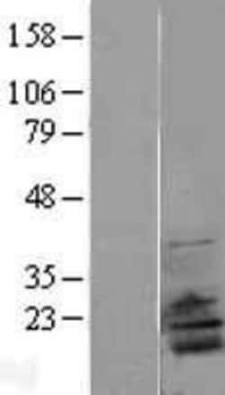 Novus Biologicals&trade;&nbsp;RPL28 Overexpression Lysate