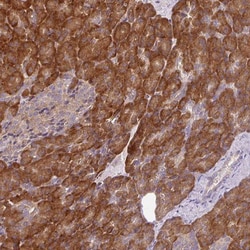 RPL28 Antibody, Novus Biologicals 25 &mu;L, Unlabeled:Antibodies, Polyclonal