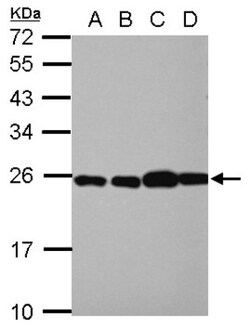 RPL29 Antibody, Novus Biologicals 0.1mL; Unlabeled:Antibodies, Polyclonal