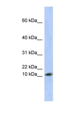 RPL30 Antibody, Novus Biologicals:Antibodies:Primary Antibodies