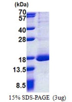 Novus Biologicals&trade;&nbsp;Recombinant Human RPL30 His Protein