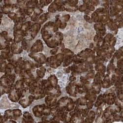 RPL34 Antibody, Novus Biologicals 25ul | Buy Online | Novus Biologicals | Fisher Scientific