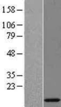 Novus Biologicals™ RPL35A Overexpression Lysate