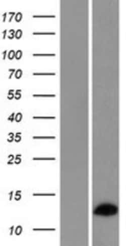 Novus Biologicals&trade;&nbsp;RPL36AL Overexpression Lysate