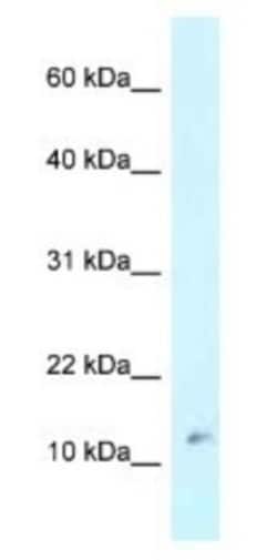 RPL37 Antibody, Novus Biologicals 20&mu;L; Unlabeled:Antibodies, Polyclonal