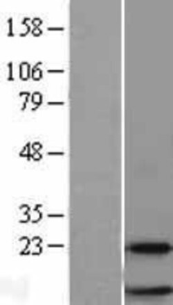 Novus Biologicals&trade;&nbsp;RPL38 Overexpression Lysate