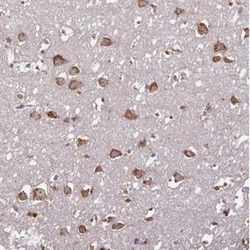 RPL38 Antibody, Novus Biologicals 25 &mu;L, Unlabeled:Antibodies, Polyclonal