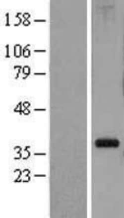Novus Biologicals&trade;&nbsp;RPL5 Overexpression Lysate