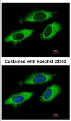 RPL6 Antibody, Novus Biologicals 0.1mL; Unlabeled:Antibodies, Polyclonal