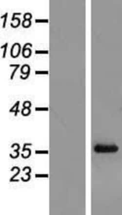 Novus Biologicals&trade;&nbsp;RPL6 Overexpression Lysate