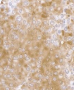 RPL7 Antibody, Novus Biologicals 0.1mL; Unlabeled:Antibodies, Polyclonal