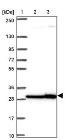 RPL7 Antibody, Novus Biologicals 0.1 mL | Buy Online | Novus Biologicals | Fisher Scientific