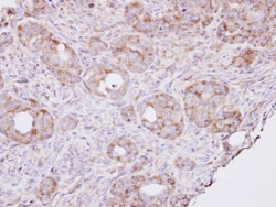 RPL8 Antibody, Novus Biologicals 0.1mL; Unlabeled:Antibodies, Polyclonal