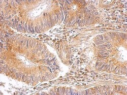 RPL8 Antibody, Novus Biologicals 0.1mL; Unlabeled:Antibodies, Polyclonal