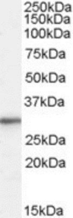 RPL8 Antibody, Novus Biologicals 0.1 mg | Buy Online | Novus Biologicals | Fisher Scientific