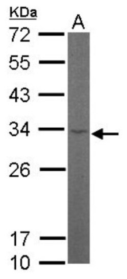 RPL8 Antibody, Novus Biologicals 0.1mL; Unlabeled:Antibodies, Polyclonal