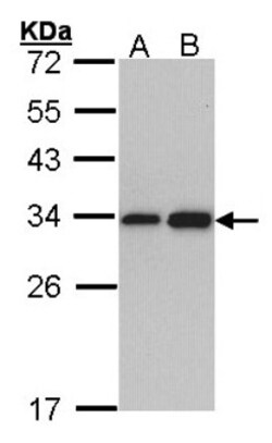 RPL8 Antibody, Novus Biologicals 0.1mL; Unlabeled:Antibodies, Polyclonal