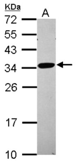 RPL8 Antibody, Novus Biologicals 0.1mL; Unlabeled:Antibodies, Polyclonal