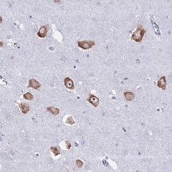 RPL8 Antibody, Novus Biologicals 25 &mu;L; Unlabeled:Antibodies, Polyclonal