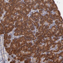 RPL9 Antibody, Novus Biologicals 0.1mL; Unlabeled:Antibodies, Polyclonal
