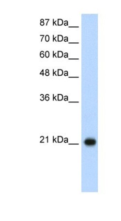 RPL9 Antibody, Novus Biologicals 0.1mg; Unlabeled:Antibodies, Polyclonal