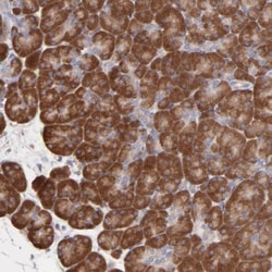RPLP0 Antibody, Novus Biologicals 0.1mL; Unlabeled:Antibodies, Polyclonal