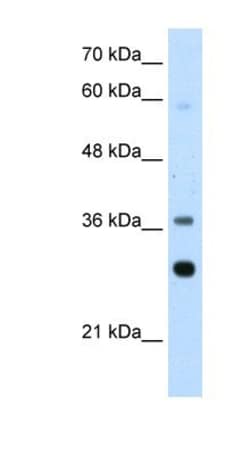 RPLP0 Antibody, Novus Biologicals 0.1mg; Unlabeled:Antibodies, Polyclonal