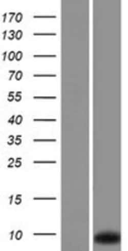 Novus Biologicals&trade;&nbsp;RPLP1 Overexpression Lysate