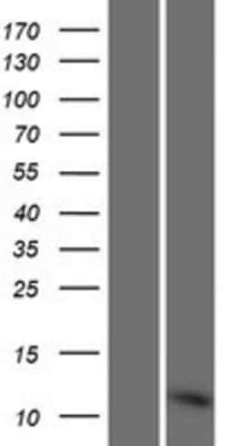 Novus Biologicals&trade;&nbsp;RPLP1 Overexpression Lysate