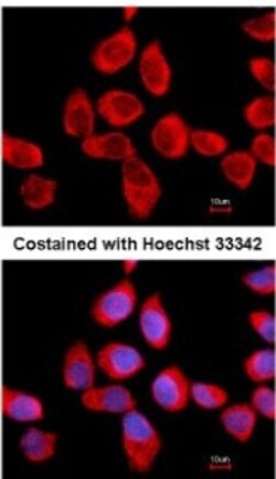 RPLP2 Antibody, Novus Biologicals 0.1mL; Unlabeled:Antibodies, Polyclonal