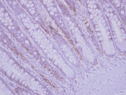 RPLP2 Antibody, Novus Biologicals 0.1mL; Unlabeled:Antibodies, Polyclonal