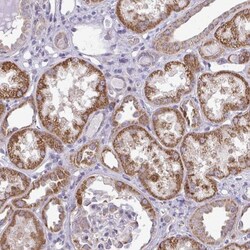 RPLP2 Antibody, Novus Biologicals:Antibodies:Primary Antibodies