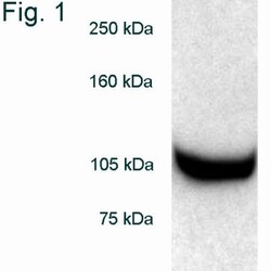 Rpn2 Antibody, Novus Biologicals 0.1mg; Unlabeled:Antibodies, Polyclonal