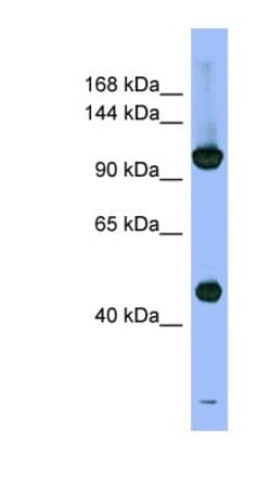 Rpn2 Antibody, Novus Biologicals 100 &mu;L | Buy Online | Novus Biologicals | Fisher Scientific