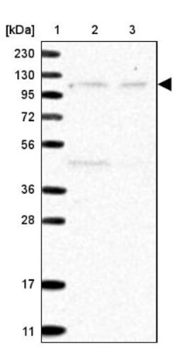 Rpn2 Antibody, Novus Biologicals 0.1 mL | Buy Online | Novus Biologicals | Fisher Scientific