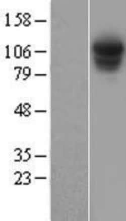 Novus Biologicals&trade;&nbsp;Rpn2 Overexpression Lysate