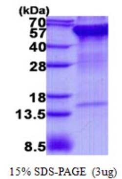 Novus Biologicals Recombinant Human Rpn2 His Protein 0.1 mg | Buy Online | Novus Biologicals&trade; | Fisher Scientific