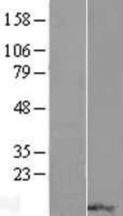 Novus Biologicals&trade;&nbsp;RPP14 Overexpression Lysate