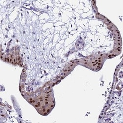 RPP20 Antibody, Novus Biologicals 25 &mu;L, Unlabeled:Antibodies, Polyclonal