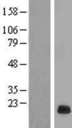 Novus Biologicals&trade;&nbsp;RPP21 Overexpression Lysate