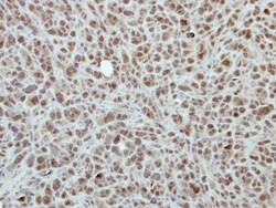 RPP30 Antibody, Novus Biologicals 0.1mL; Unlabeled:Antibodies, Polyclonal