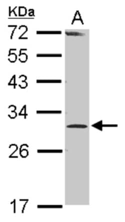 RPP30 Antibody, Novus Biologicals 0.1mL; Unlabeled:Antibodies, Polyclonal