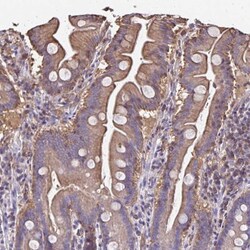 RPRML Antibody, Novus Biologicals:Antibodies:Primary Antibodies