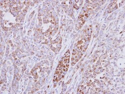 RPS10 Antibody, Novus Biologicals 0.1 mL | Buy Online | Novus Biologicals | Fisher Scientific