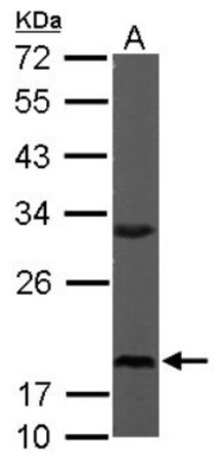RPS10 Antibody, Novus Biologicals 0.1 mL | Buy Online | Novus Biologicals | Fisher Scientific