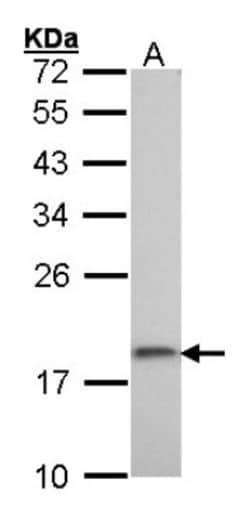 RPS10 Antibody, Novus Biologicals 0.1 mL | Buy Online | Novus Biologicals | Fisher Scientific
