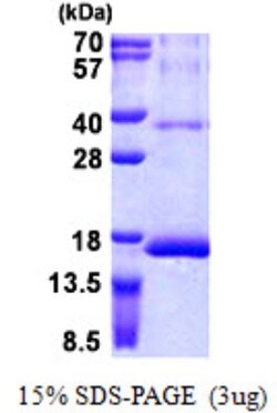 Novus Biologicals&trade;&nbsp;Recombinant Human RPS12 His Protein