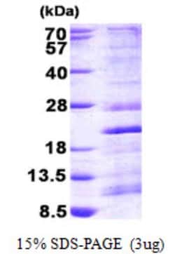 Novus Biologicals&trade;&nbsp;Recombinant Human RPS13 His Protein
